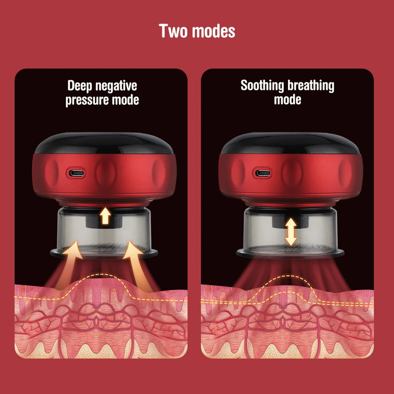 Electric Vacuum Cupping Body Massage